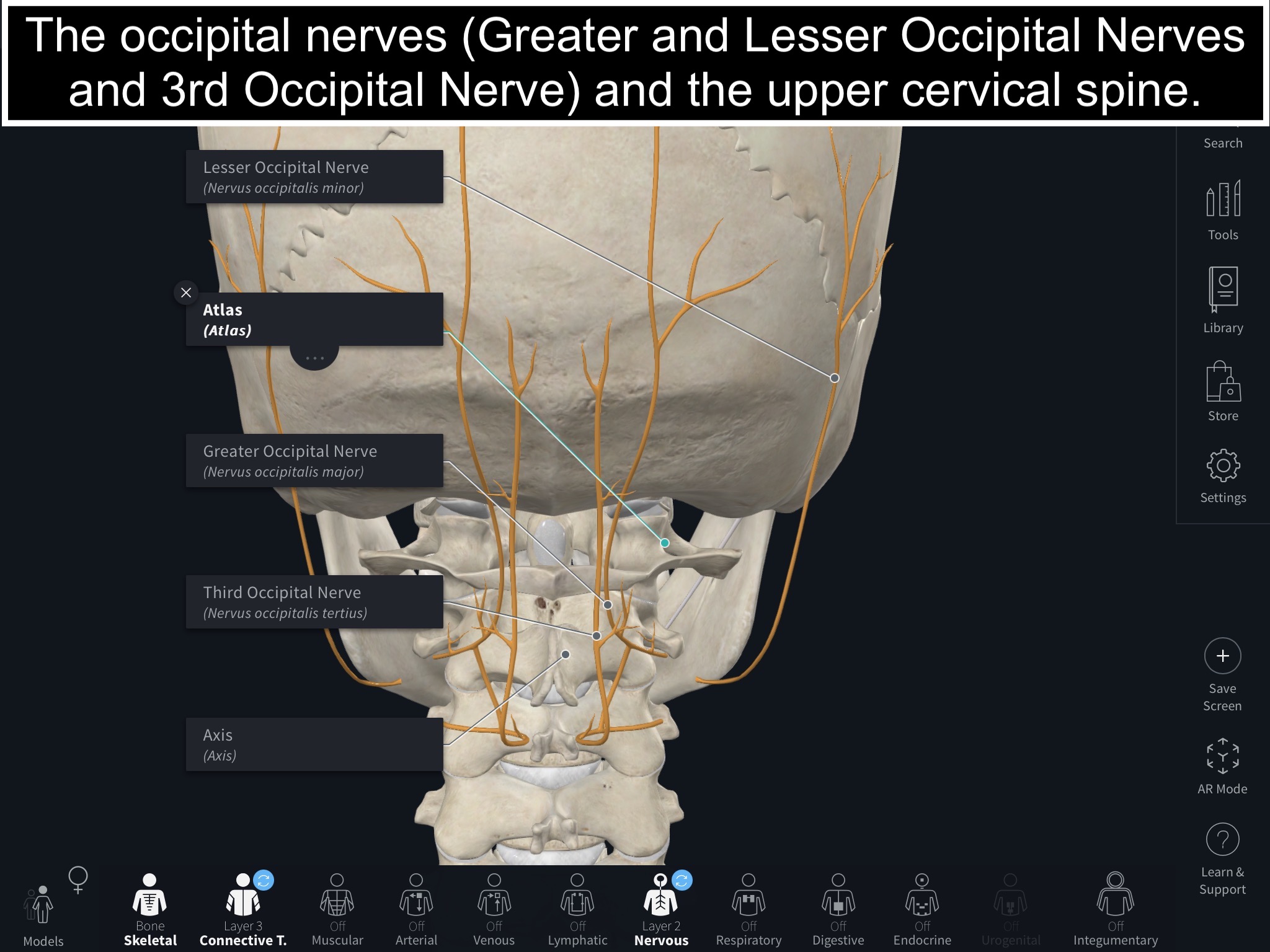 Headache - Occipital Nerves